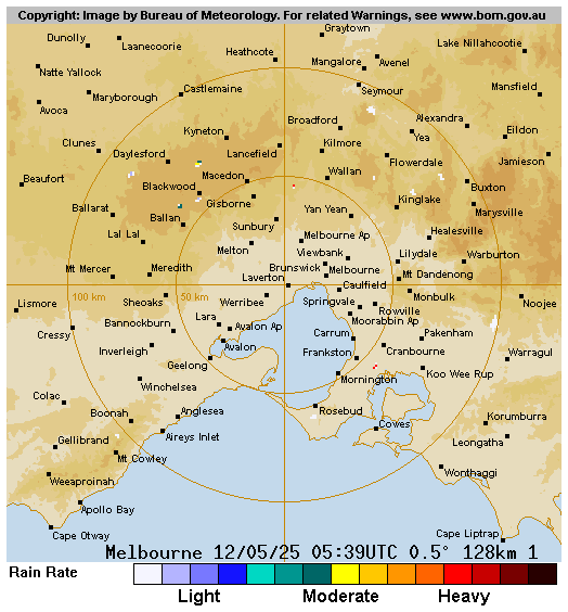Radar